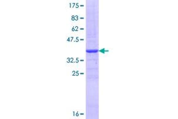 CD15 Protein (AA 167-265) (GST tag)