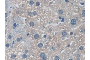Detection of NXN in Mouse Liver Tissue using Polyclonal Antibody to Nucleoredoxin (NXN) (NXN Antikörper  (AA 167-435))