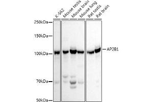 Western blot analysis of extracts of various cell lines, using B1 antibody (ABIN3015809, ABIN3015810, ABIN3015811 and ABIN6219156) at 1:500 dilution. (AP2B1 Antikörper  (AA 752-951))