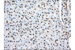 Immunohistochemical staining of paraffin-embedded Human liver tissue using anti-ACAT2 mouse monoclonal antibody. (ACAT2 Antikörper)