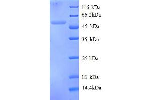 SDS-PAGE (SDS) image for Tubulin, beta 1 (TUBB1) (AA 1-439), (partial) protein (His tag) (ABIN5713152)