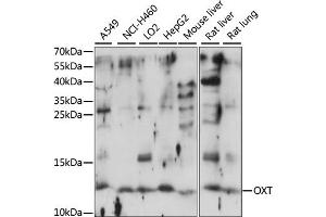 Western blot analysis of extracts of various cell lines, using OXT antibody (ABIN7269141) at 1:1000 dilution. (OXT Antikörper  (AA 1-125))