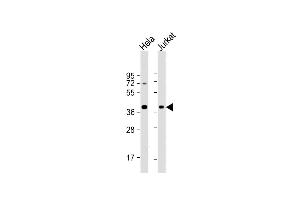 All lanes : Anti-HSP40 Antibody at 1:4000 dilution Lane 1: Hela whole cell lysate Lane 2: Jurkat whole cell lysate Lysates/proteins at 20 μg per lane. (DNAJB1 Antikörper)