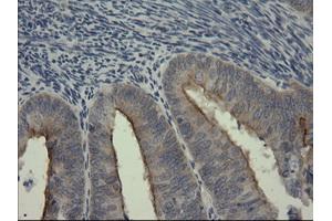 Image no. 3 for anti-serpin Peptidase Inhibitor, Clade B (Ovalbumin), Member 3 (SERPINB3) antibody (ABIN1500886)