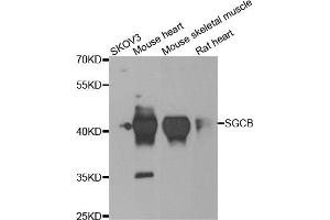 Western blot analysis of extracts of various cell lines, using SGCB antibody. (SGCB Antikörper)