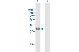 Western Blot analysis of ACADM expression in transfected 293T cell line by ACADM MaxPab polyclonal antibody. (Medium-Chain Specific Acyl-CoA Dehydrogenase, Mitochondrial (MCAD) (AA 1-421) Antikörper)