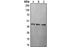 Western blot analysis of CREB expression in MCF7 (A), mouse brain (B), rat brain (C) whole cell lysates. (CREB1 Antikörper  (Center))