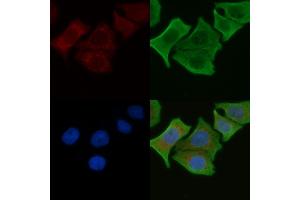 ABIN6262532 and ABIN6276906 staining Hela cells by IF/ICC.