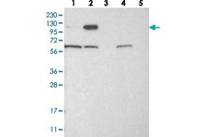 Western blot analysis of Lane 1: RT-4, Lane 2: U-251 MG, Lane 3: Human Plasma, Lane 4: Liver, Lane 5: Tonsil with IGSF9 polyclonal antibody . (IGSF9 Antikörper)