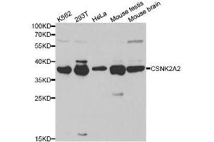 Western blot analysis of extracts of various cell lines, using CSNK2A2 antibody. (CSNK2A2 Antikörper  (AA 1-350))