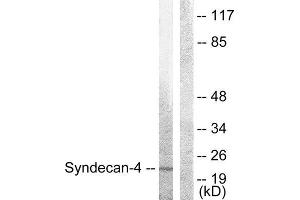 Western Blotting (WB) image for anti-Syndecan 4 (SDC4) (Ser179) antibody (ABIN1848043) (SDC4 Antikörper  (Ser179))