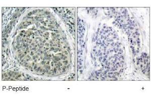 Image no. 1 for anti-Catenin (Cadherin-Associated Protein), beta 1, 88kDa (CTNNB1) (pSer37) antibody (ABIN196958) (CTNNB1 Antikörper  (pSer37))