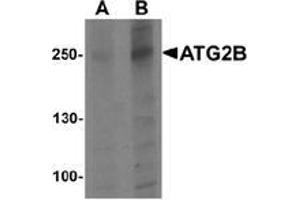 Western blot analysis of ATG2B in K562 cell lysate with ATG2B Antibody  at (A) 1 and (B) 2 μg/ml.