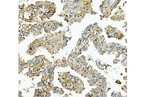 IHC analysis of Hexokinase 1/HK1 using anti-Hexokinase 1/HK1 antibody (ABIN7600259). (Hexokinase 1 Antikörper  (AA 17-323))