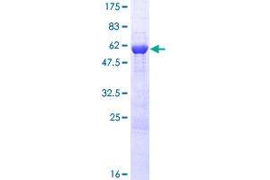 Image no. 1 for Proto-Oncogene Pim-2 (Serine Threonine Kinase) (PIM2) (AA 1-311) protein (GST tag) (ABIN1315104) (PIM2 Protein (AA 1-311) (GST tag))