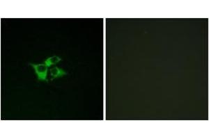 Immunofluorescence analysis of COS7 cells, using EDNRA Antibody. (Endothelin-1 Receptor Antikörper  (AA 378-427))