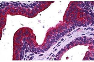 Human Prostate: Formalin-Fixed, Paraffin-Embedded (FFPE) (MAPK13 Antikörper  (AA 251-365))