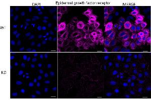 Immunocytochemical staining of HepG2 cells using Epidermal growth factor receptor antibody (ABIN7798473), 1:1,000), Top panel: wild-type (WT), Bottom panal: Adiponectin receptor 1 shRNA knockdown (KD).