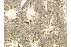 FAS Mouse Monoclonal Antibody at 1/100 staining mouse testis tissue by IHC-P.