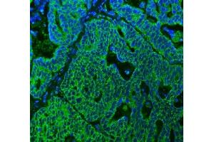 IF analysis of SUCLG2 using anti-SUCLG2 antibody (ABIN7601694). (SUCLG2 Antikörper  (AA 42-424))