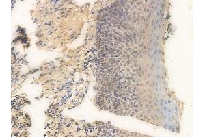 ABIN6265700 and ABIN6266665 at 1/100 staining human normal tonsil tissue by IHC-P.