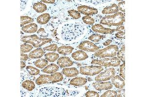 IHC analysis of IRAK2 using anti-IRAK2 antibody (ABIN7602761).