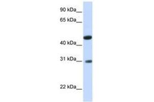 Image no. 1 for anti-Glycolipid Transfer Protein Domain Containing 2 (GLTPD2) (AA 36-85) antibody (ABIN6740898)