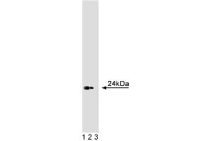 Western blot analysis of Caveolin 1 on a human endothelial cell lysate. (Caveolin-1 Antikörper  (AA 1-178))