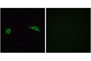 Immunofluorescence analysis of A549 cells, using OR2J2 Antibody. (OR2J2 Antikörper  (AA 263-312))