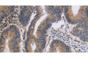 Immunohistochemistry (Paraffin-embedded Sections) (IHC (p)) image for anti-Inositol 1,4,5-Trisphosphate Receptor, Type 1 (ITPR1) antibody (ABIN7239107)