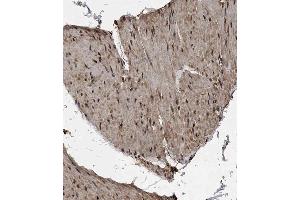 Immunohistochemical analysis of B on paraffin-embedded Human bladder tissue. (MET10 (AA 444-472), (C-Term) Antikörper)