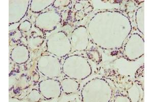 Immunohistochemistry of paraffin-embedded human thyroid tissue using ABIN7161975 at dilution of 1:100 (NOL4L (AA 101-300) Antikörper)
