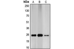 Western blot analysis of p27 Kip1 expression in MCF7 (A), HEK293T (B), PC12 (C) whole cell lysates. (CDKN1B Antikörper  (C-Term))