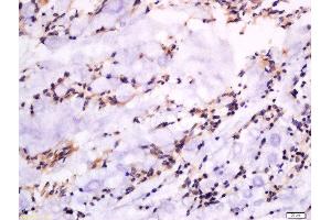Formalin-fixed and paraffin embedded rat rectum labeled with Anti-GSDMA Polyclonal Antibody, Unconjugated  at 1:300 followed by conjugation to the secondary antibody and DAB staining. (Gasdermin A Antikörper  (AA 21-120))