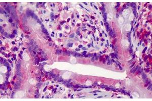 Human Small Intestine: Formalin-Fixed, Paraffin-Embedded (FFPE) (Caspase 7 Antikörper)