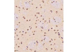 Immunohistochemistry of paraffin embedded rat brain using SR140 (ABIN7076091) at dilution of 1:1000 (400x lens) (SR140 Antikörper)