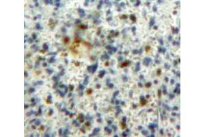 IHC-P analysis of Spleen tissue, with DAB staining. (GM-CSF Antikörper  (AA 18-144))