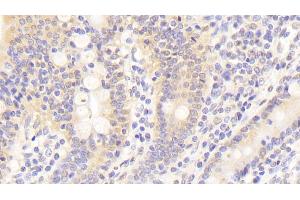Detection of KNG1 in Human Small intestine Tissue using Polyclonal Antibody to Kininogen 1 (KNG1) (KNG1 Antikörper  (AA 390-644))