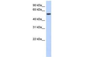 Image no. 1 for anti-Deoxynucleotidyltransferase, terminal (DNTT) (C-Term) antibody (ABIN6743611) (TdT Antikörper  (C-Term))