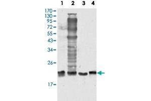 Western blot analysis of SOD1 monoclonal antobody, clone 6F5  against HeLa (1), NIH/3T3 (2), A-549 (3) and A-431 (4) cell lysate. (SOD1 Antikörper)