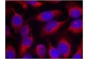 Image no. 1 for anti-Myristoylated Alanine-Rich Protein Kinase C Substrate (MARCKS) (Ser158) antibody (ABIN197560) (MARCKS Antikörper  (Ser158))