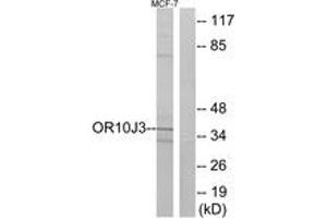 Western blot analysis of extracts from MCF-7 cells, using OR10J3 Antibody. (OR10J3 Antikörper  (AA 237-286))