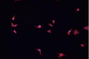 ABIN6267044 staining A-431 cells by IF/ICC. (NF-kB p65 Antikörper  (C-Term))