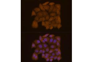 Immunofluorescence analysis of HeLa cells using Galectin 3/LG Rabbit mAb (ABIN7267337) at dilution of 1:50 (40x lens). (Galectin 3 Antikörper)