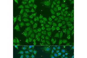 Immunofluorescence analysis of U2OS cells using AKR7A3 Polyclonal Antibody at dilution of 1:100. (AKR7A3 Antikörper)