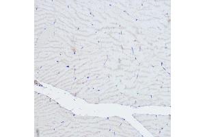 Immunohistochemistry of paraffin-embedded rat skeletal muscle using  Rabbit pAb (ABIN6127422, ABIN6136487, ABIN6136489 and ABIN6216551) at dilution of 1:500 (40x lens). (ACTN3 Antikörper  (AA 580-630))