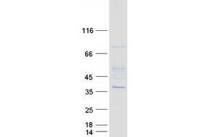 Validation with Western Blot (HUS1 Protein (Myc-DYKDDDDK Tag))