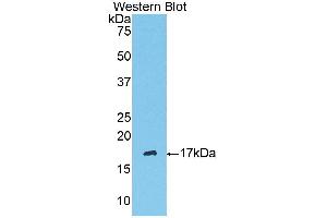 Western Blotting (WB) image for anti-Serpin Peptidase Inhibitor, Clade G (C1 Inhibitor), Member 1 (SERPING1) (AA 397-495) antibody (ABIN3208985) (SERPING1 Antikörper  (AA 397-495))