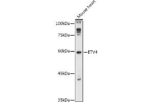 Western blot analysis of extracts of Mouse heart, using ETV4 antibody (ABIN6131216, ABIN6140331, ABIN6140333 and ABIN6218006) at 1:1000 dilution. (ETV4 Antikörper  (AA 79-178))