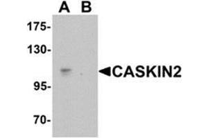 Western blot analysis of CASKIN2 in Hela cell lysate with CASKIN2 Antibody  at 1 ug/mL in (A) the absence and (B) the presence of blocking peptide. (CASKIN2 Antikörper  (N-Term))